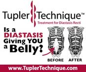 AD WITH DIASTASIS FOR BLOG 2