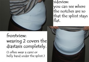 splintsday1