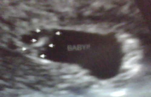 Baby 6w