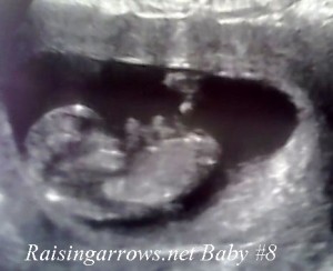 11 week sonogram
