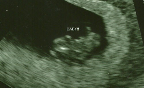 Baby8 Baby #8