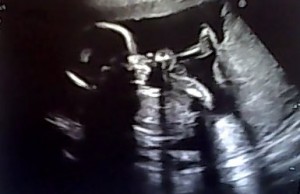 baby18wks