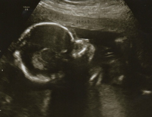 Baby #9 Week 19 | RaisingArrows.net